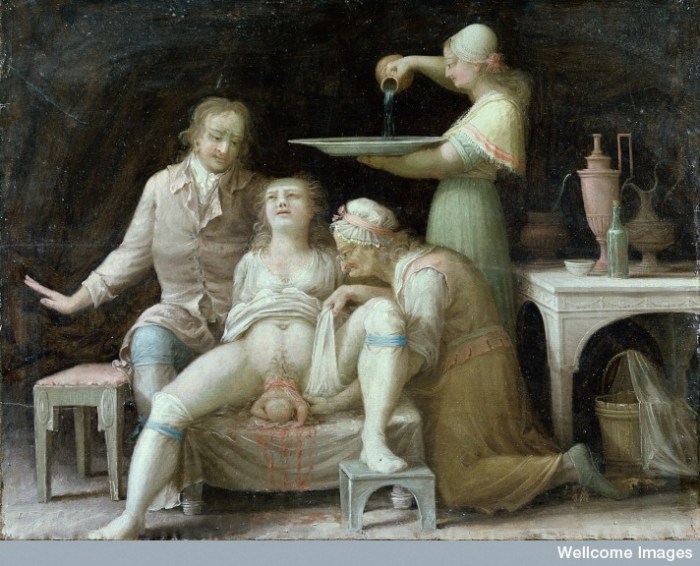 L0015387 A birth-scene. Oil painting by a French (?) painter, Åbo, Sw Credit: Wellcome Library, London. Wellcome Images images@wellcome.ac.uk http://wellcomeimages.org A birth-scene. Oil painting by a French (?) painter, Åbo, Sweden (later Turku, Finland), 1800. The proud father is on the left, the woman giving birth is in the centre, and on the right is a caricature of a midwife or wisewoman. The standing figure pouring water into a bowl may be a personification of Hygiene, as a similar figure appears on a Wedgwood plaque of the goddess Hygieia. At the same time she is the maid who is preparing to wash the baby. The furniture is of an advanced neo-classical type: it would be slightly surprising if such furniture were in Åbo at the time. The painting may be by a French painter in Sweden. Oil 1800 Published: - Copyrighted work available under Creative Commons Attribution only licence CC BY 4.0 http://creativecommons.org/licenses/by/4.0/
