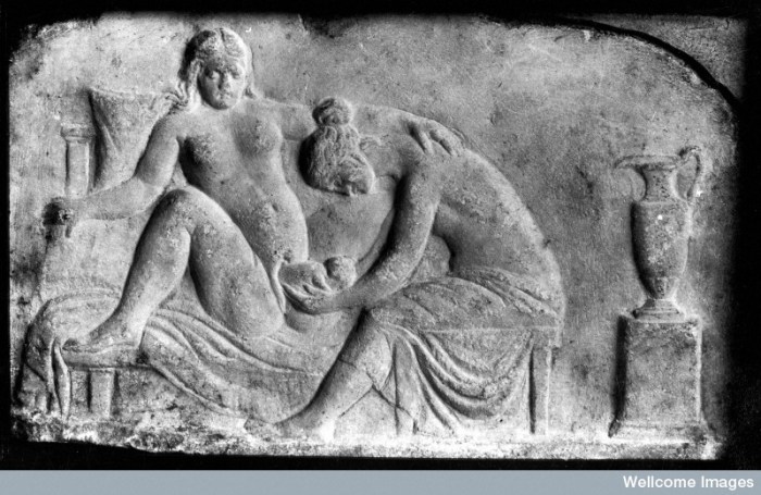 M0003964EB Ancient Roman relief carving of a midwife Credit: Wellcome Library, London. Wellcome Images images@wellcome.ac.uk http://wellcomeimages.org Ancient Roman relief carving of a midwife attending a woman giving birth. Published: - Copyrighted work available under Creative Commons Attribution only licence CC BY 4.0 http://creativecommons.org/licenses/by/4.0/